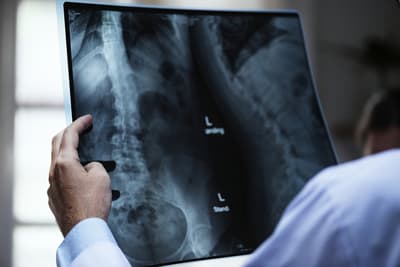 Arzt vor einem Röntgenbild