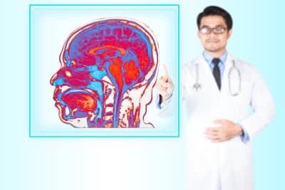 Ein Mediziner deutet auf eine Abbildung des menschlichen Gehirns.